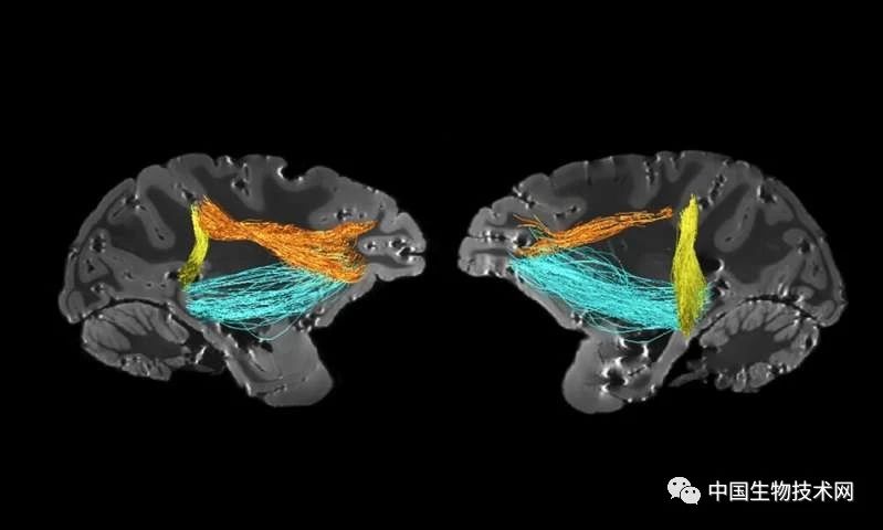 PNAS重磅：注意力调控领域发现一块“新大陆”！又是一次偶然的杰作